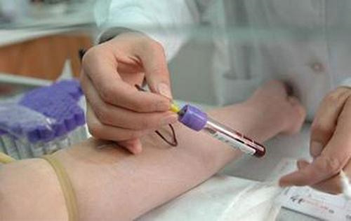香港验血哪里可以检查—是先进的，可靠和高品质验血机构