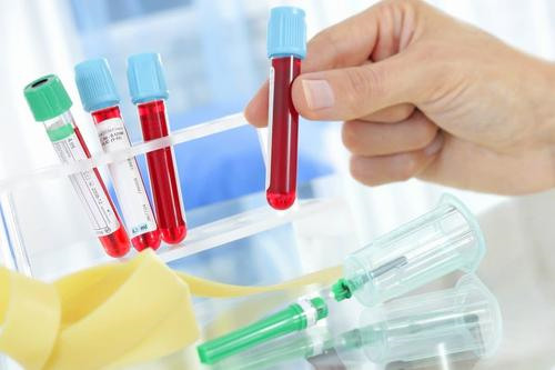 香港验血具体流程有哪些——各大化验所均有合作