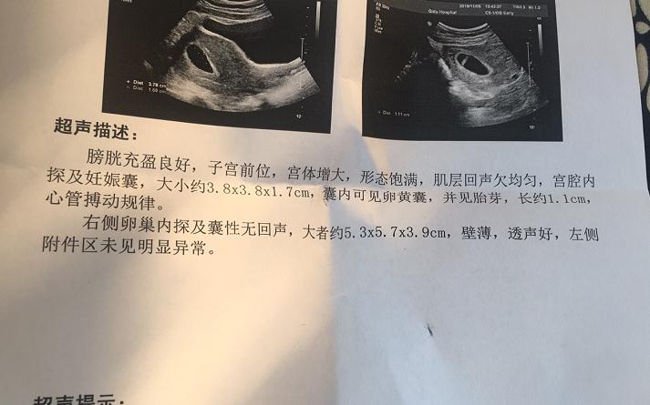 去香港验男女机构,查胎儿性别要多少钱？